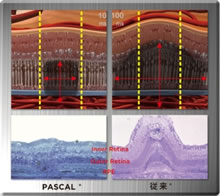 痛みが少ないレーザー